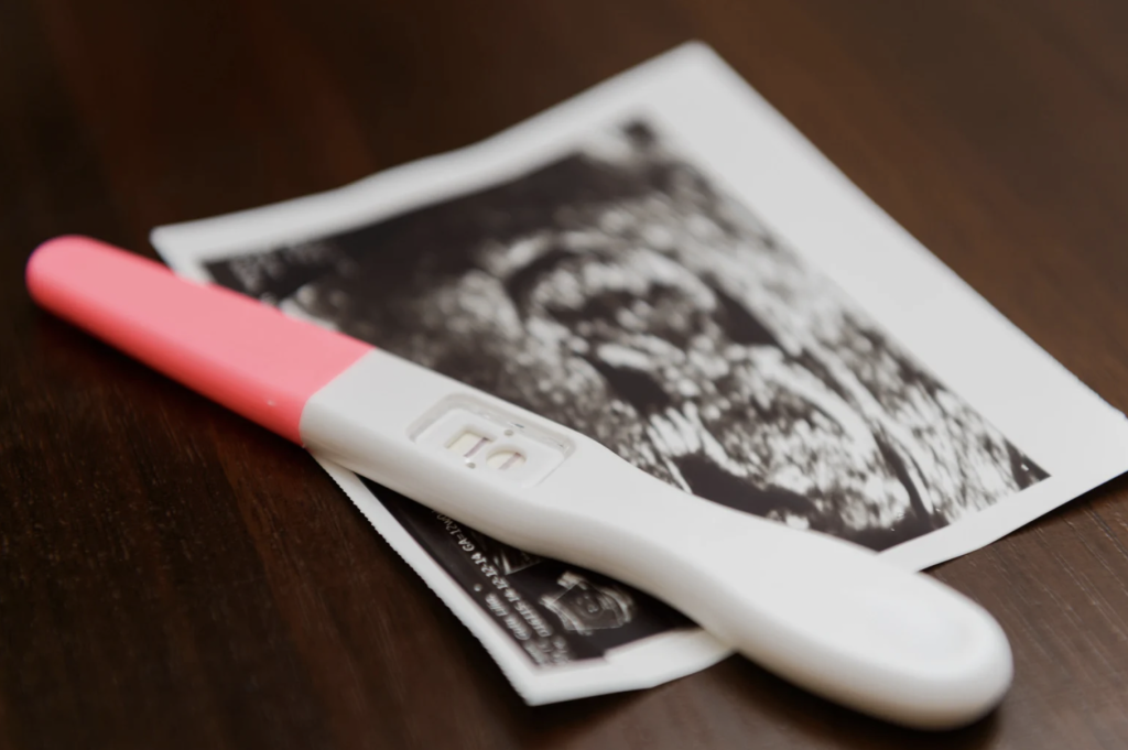 Positive Pregnancy Test In Scotland